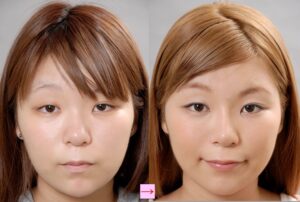 尾崎美紀 鼻